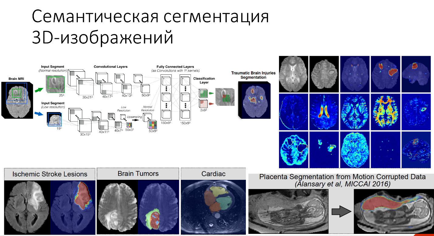 Нейросеть для сегментации изображений